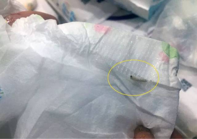 凯里一妈妈买的纸尿裤里爬出活虫!还不止一包