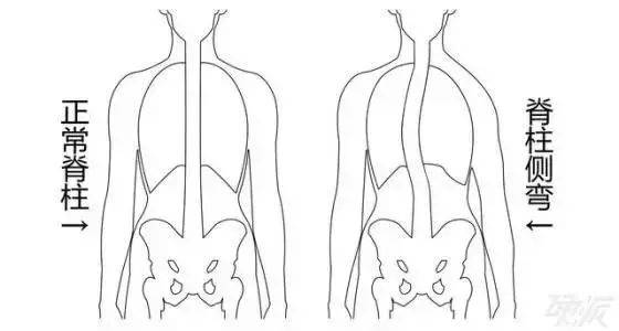 4 大高低肩的危害,幸好有矫正方法!