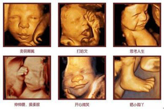 怀孕四个月的胎儿有多大,发育成什么样儿了?很可爱,孕
