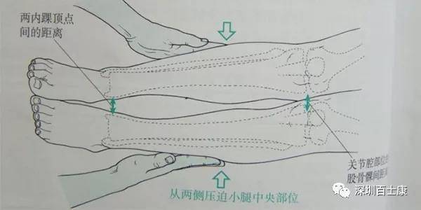 检查股四头肌的跟臀实验