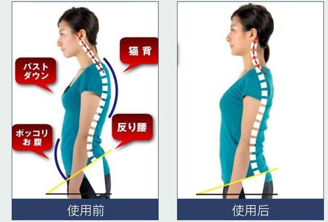 风靡日本的驼背矫正带了解一下!
