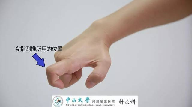 歪嘴面瘫,常规治疗外,这些在家就能做康复操,穴位按摩