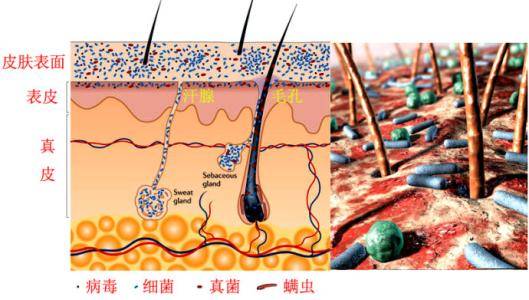 是指由细菌,真菌,病毒,螨虫和节肢动物等各种微生物与皮肤表面的组织
