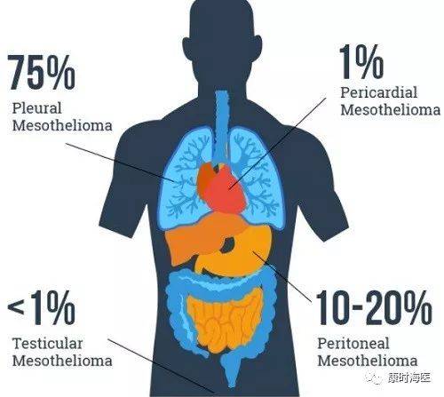 石棉癌:由石棉引起的一系列癌症