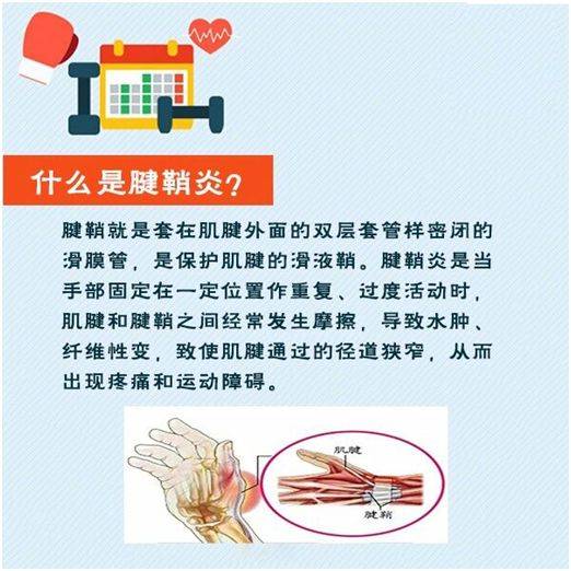 解惑手指疼痛难忍可能是腱鞘炎在作祟