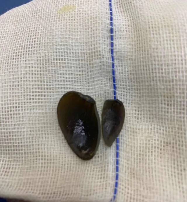 盘点10张不可思议的猫咪x光片,真相令人后怕!