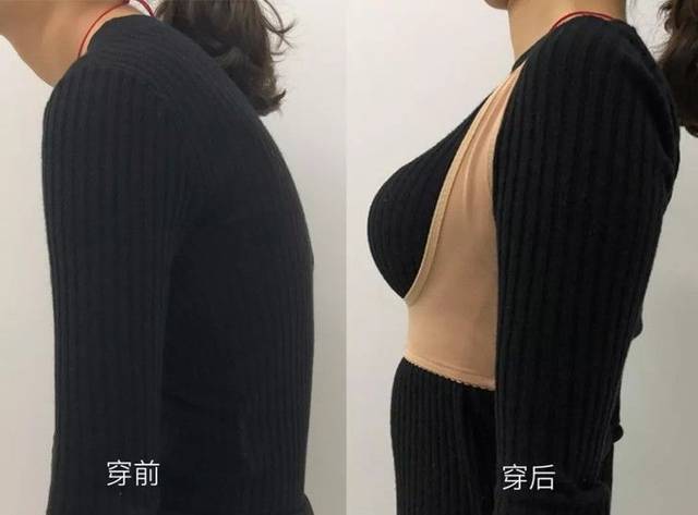 副乳不见了,胸部也更加挺拔,真实买家秀