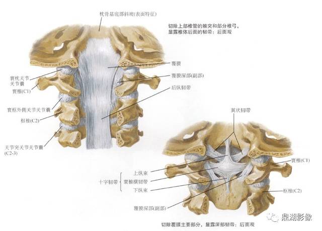 x线高清图谱 | 寰枢关节半脱位诊断要点!一篇文章搞定
