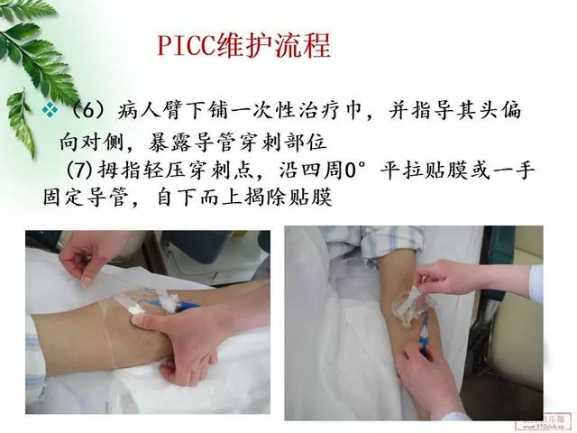 【ppt】picc导管的维护,这篇真的很详细!