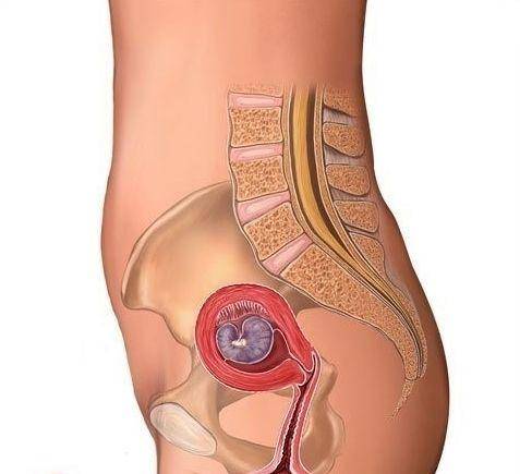 胎宝照四维彩超时五官看起来好丑,主要是没长开