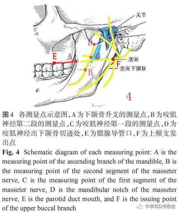 经口内定位面神经颊支与咬肌神经的相关解剖研究