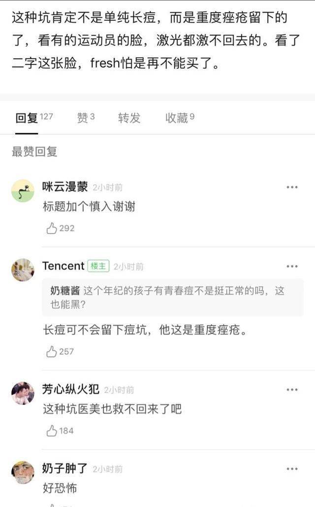 tfboys 王源被爆重度痤疮?演唱会现场未精修图网曝光