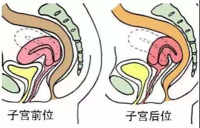 辩证看待子宫后位,出现腰酸,肛门坠胀未必就不好怀孕_手机搜狐网