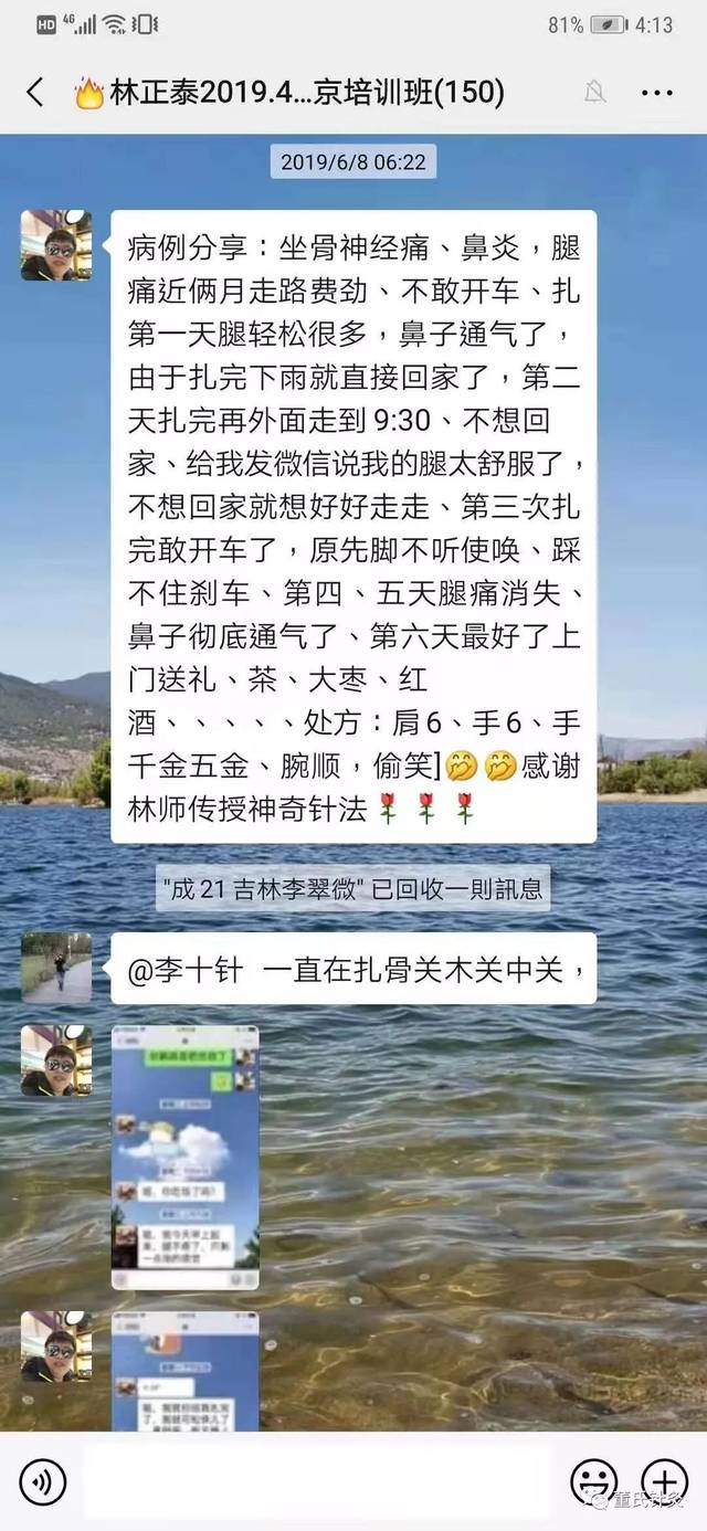 坐骨神经痛针灸位置图 环跳的准确位置图 坐骨痛扎针图 第15页 大山谷图库