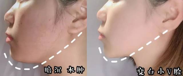 韩国女星私藏的抗老v脸秘籍大曝光!怪不得8