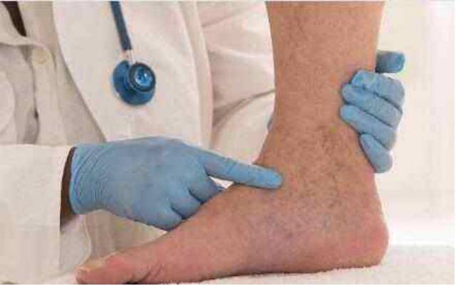 有些患者还会发生脚部血液淤积,脚踝发紫等症状. 4.