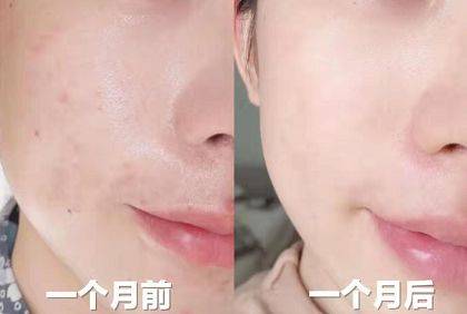 一个夏天黑5度?这个美白规律,80%的人都