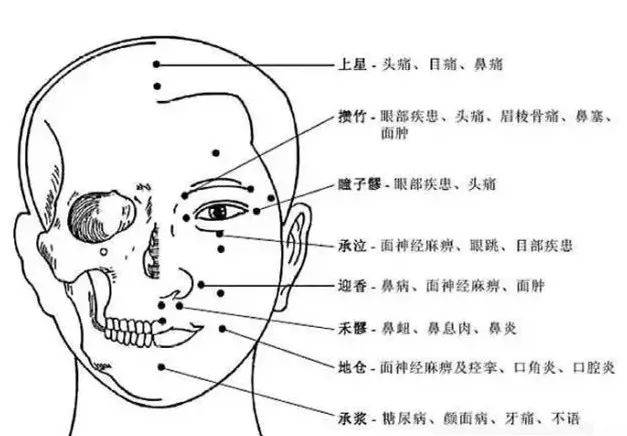 丝竹空穴:治疗偏正头痛,目眩,目赤,眼跳 睛明穴:治疗眼部诸疾患 四白