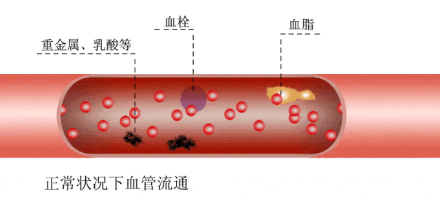脑梗塞包括常见的脑动脉硬化血栓形成性脑梗塞(简称脑血栓)和脑栓塞.