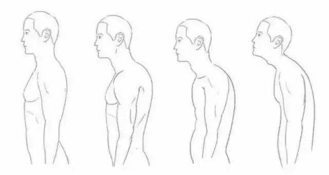 圆肩,驼背,含胸,头前引…这么多问题,其实是一个问题