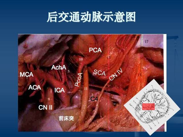 神经解剖:脑血管之动脉系和静脉系(全227页)