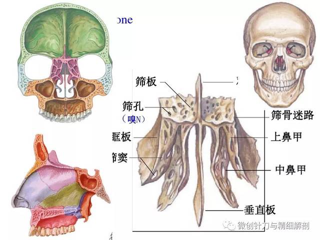 人体解剖学-颅骨