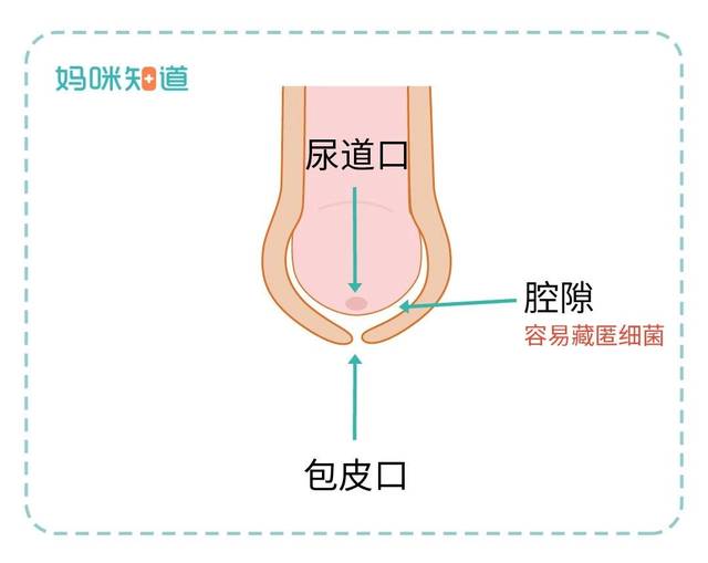 在包皮口和尿道口之间有一个腔隙,称为包皮腔,正是这个腔隙的存在