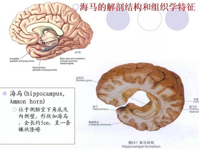 海马解剖结构与mri的诊断应用丨影像天地