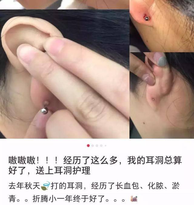 这3种人,打耳洞前一定要三思
