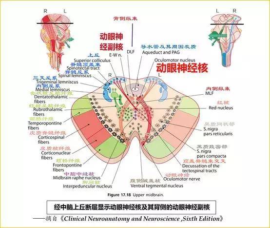 下丘层面: 滑车神经核(发出纤维构成 滑车神经).