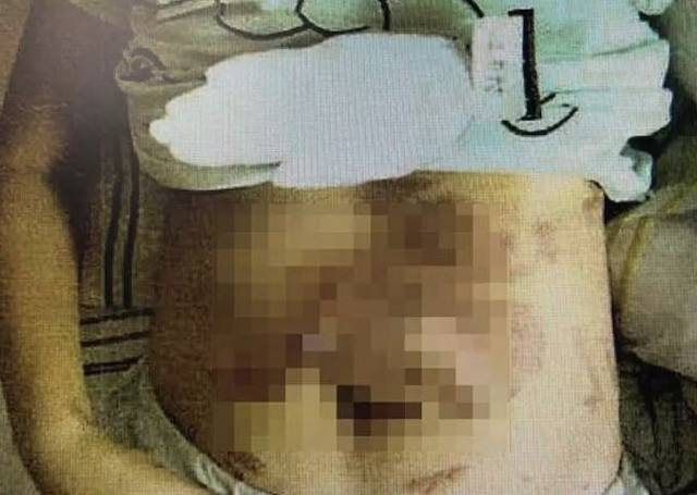 “你又不是黄花闺女”男子把火锅泼向女友