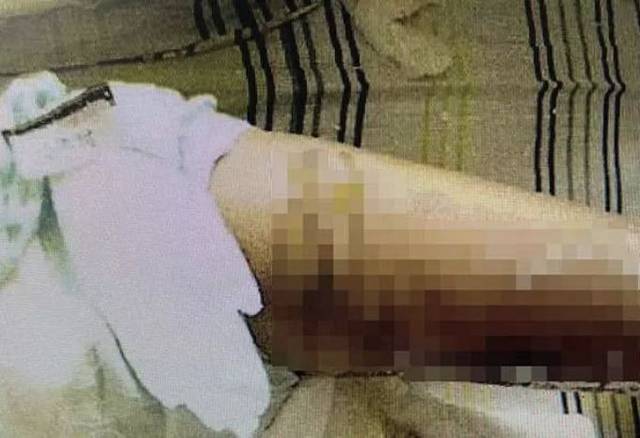 “你又不是黄花闺女”男子把火锅泼向女友