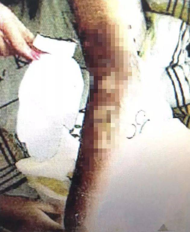“你又不是黄花闺女”男子把火锅泼向女友