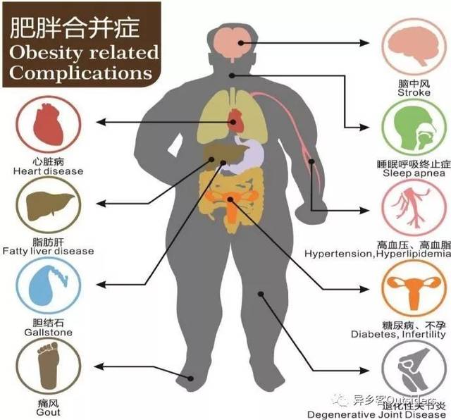 人类肥胖简史