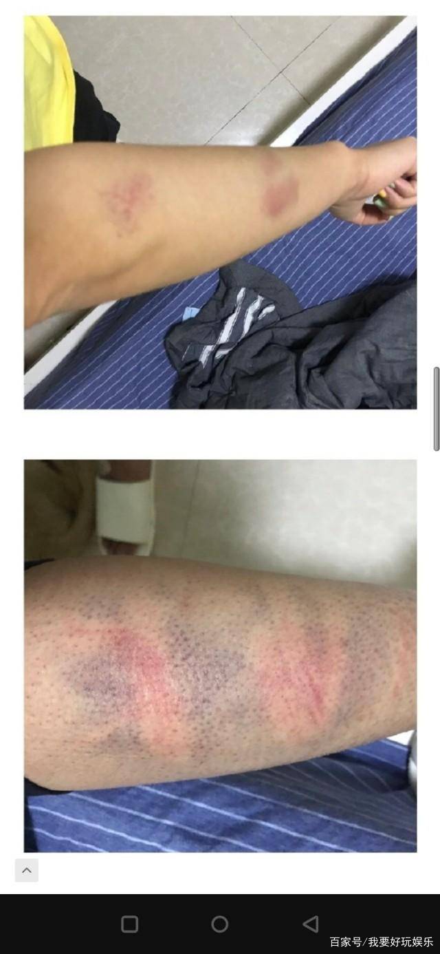 张嫮目是谁?被爆家暴细节,张嫮目照片,与女歌手强迫发生关系.