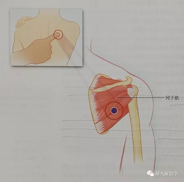 让患者将患侧的手放在对侧肩部的三角肌上可找到位于冈下肌的激痛点