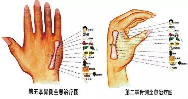 看懂这张图,穴位不用找(人体全息图)