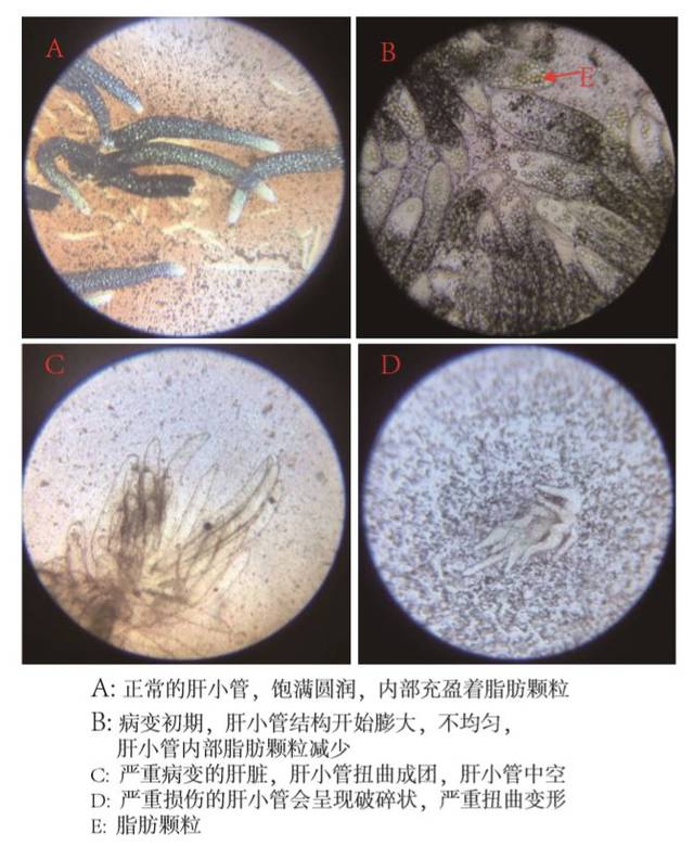 对虾肝小叶显微镜观察