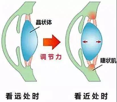 物像离得越近,所需凸透度就越大,睫状肌就会收的愈发厉害.