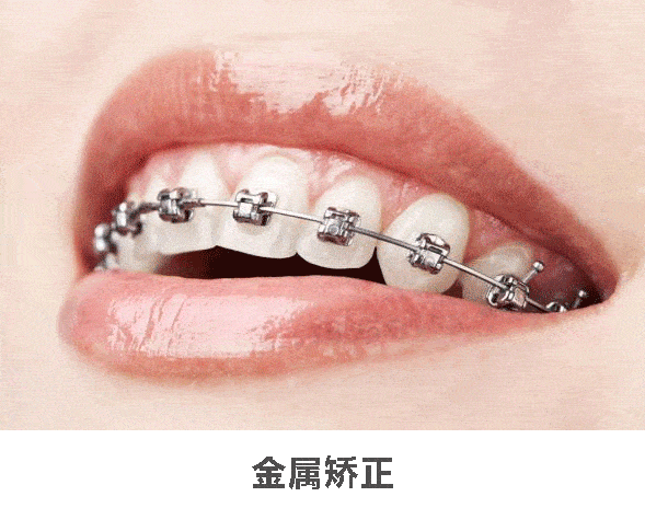 3d数字化矫正4150元!