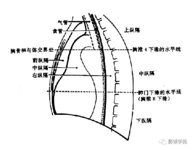 肺癌纵隔淋巴结分区_手机搜狐网