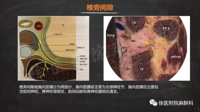 超声引导下胸椎旁神经阻滞的临床应用