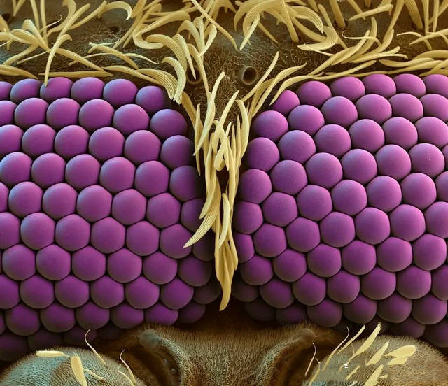 一组罕见的趣图;显微镜下蚊子的眼睛,脸盲症患者看到的人脸等