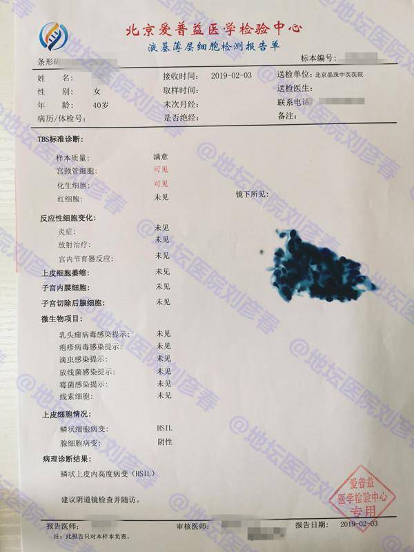 「病例分享」两次锥切后再次发现cin3级,依旧伴hpv感染,终痊愈