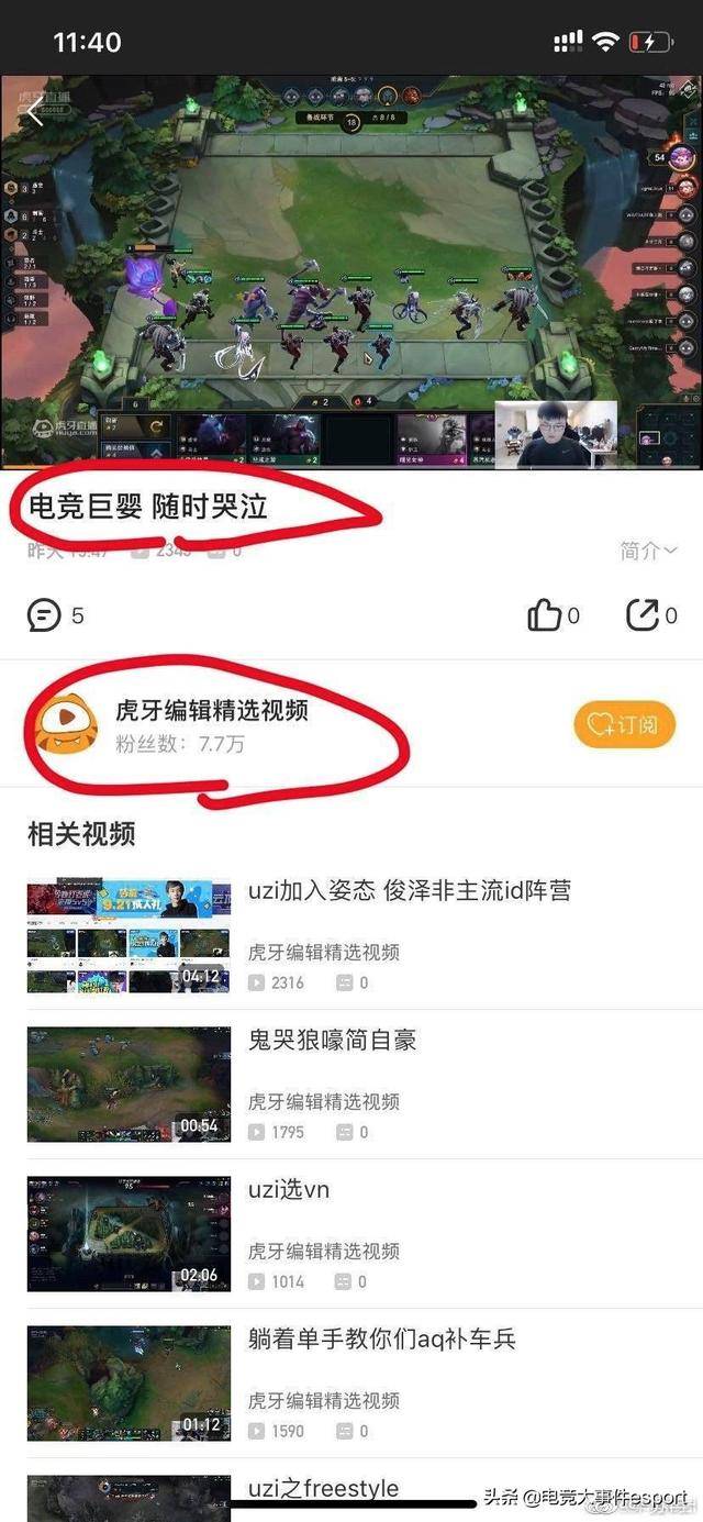 电竞巨婴Uzi?直播平台错误标题引争议,小狗女
