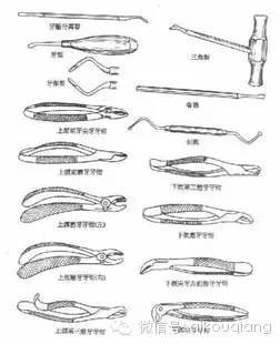 口腔麻醉拔牙术阻生牙拔除