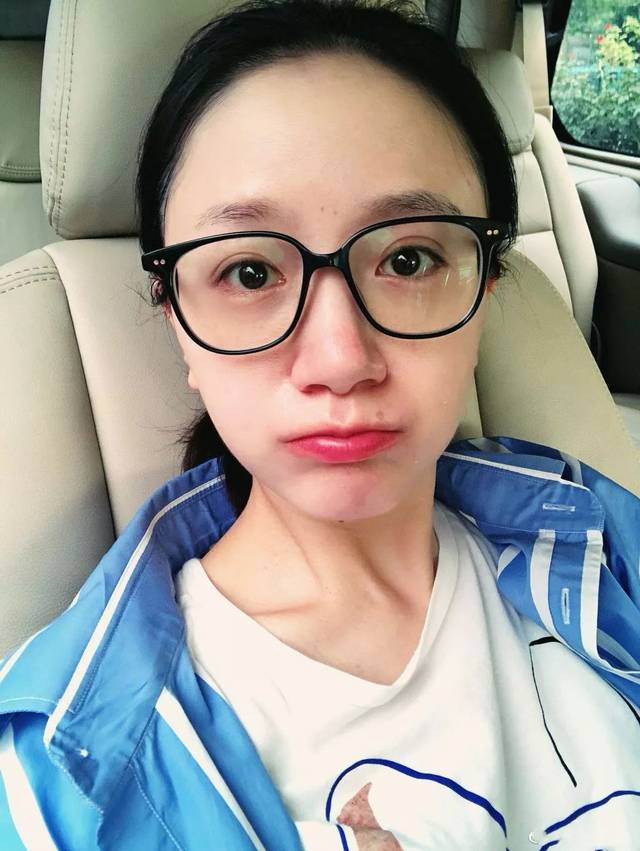 李倩晒素颜照,35岁还是一张娃娃脸,网友发现痣不见了?