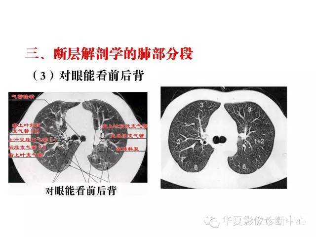 轻松掌握肺部解剖和分段