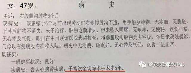 一例女性腹部包块,手把手教你如何在ct上做出病理诊断