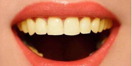 牙齿“第三次发育”